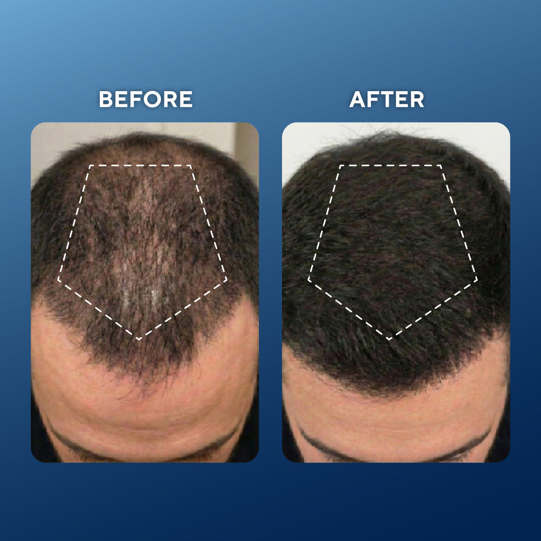 Fórmula avanzada para el crecimiento del cabello con péptidos de cobre