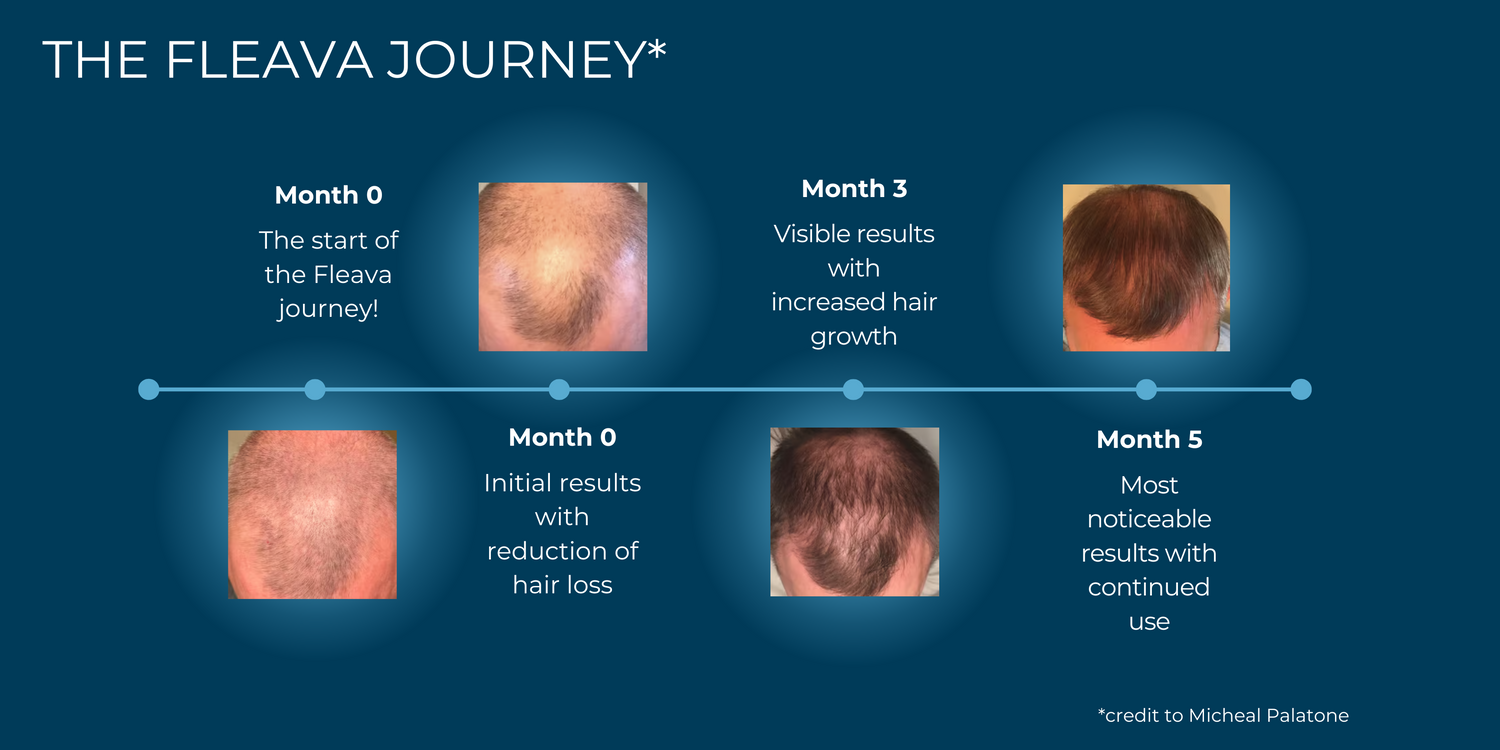 Advanced Copper Peptide Hair Regrowth Formula Fleava Advanced Copper Peptide Hair Regrowth Formula Fleava
