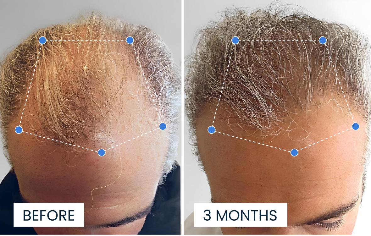 Transformación 2