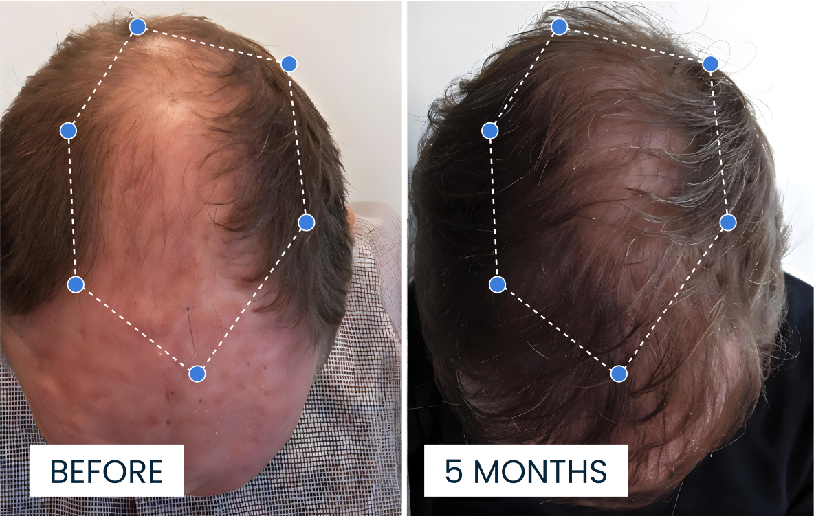 Transformación 4