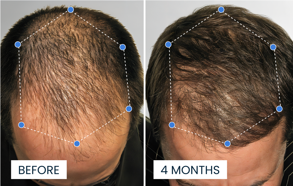 Transformación 3