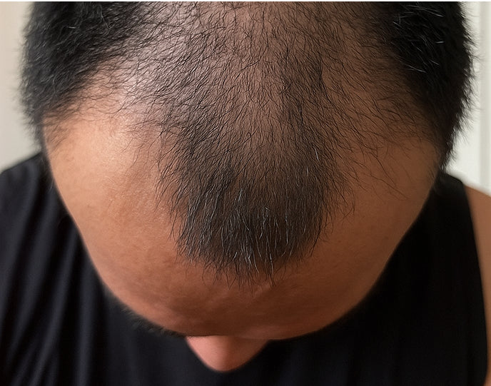 “It’s actually growing.”
