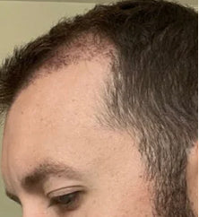Daniel W., 41